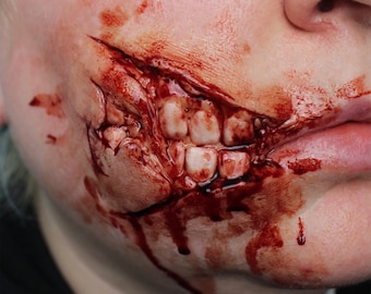 May include: A close-up of a bloody, open wound on a person's face. The wound is on the cheek and jawline, and it appears to be a deep cut. There is blood dripping from the wound, and the skin around it is red and swollen.