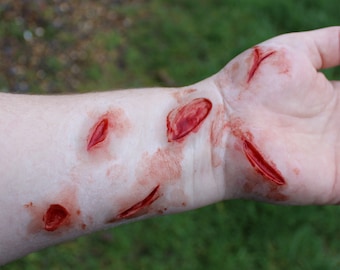 May include: Close-up of a bloody wound on a person's arm. The wound is red and appears to be a deep cut.
