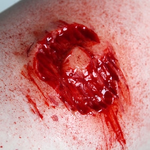 May include: A close-up of a bloody wound on skin. The wound is deep and red, with blood pooling around it.