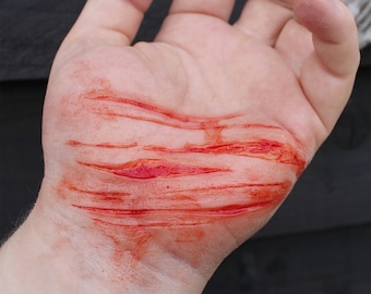 Op de afbeelding: Een close-up van een hand met meerdere diepe snijwonden die bloeden. De hand is bleek en de snijwonden zijn rood.