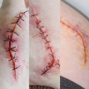 Medium Suture Wounds Set of Three Silicone Prosthetics // Encapsulated Silicone Appliances // Stitches Injury Casualty Medical // SFX MAKEUP