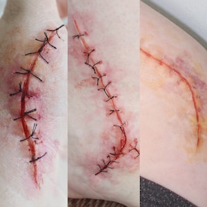 Medium Suture Scars Set of Three Silicone Prosthetics // Encapsulated Silicone Appliances // Stitches Injury Casualty Medical // SFX MAKEUP