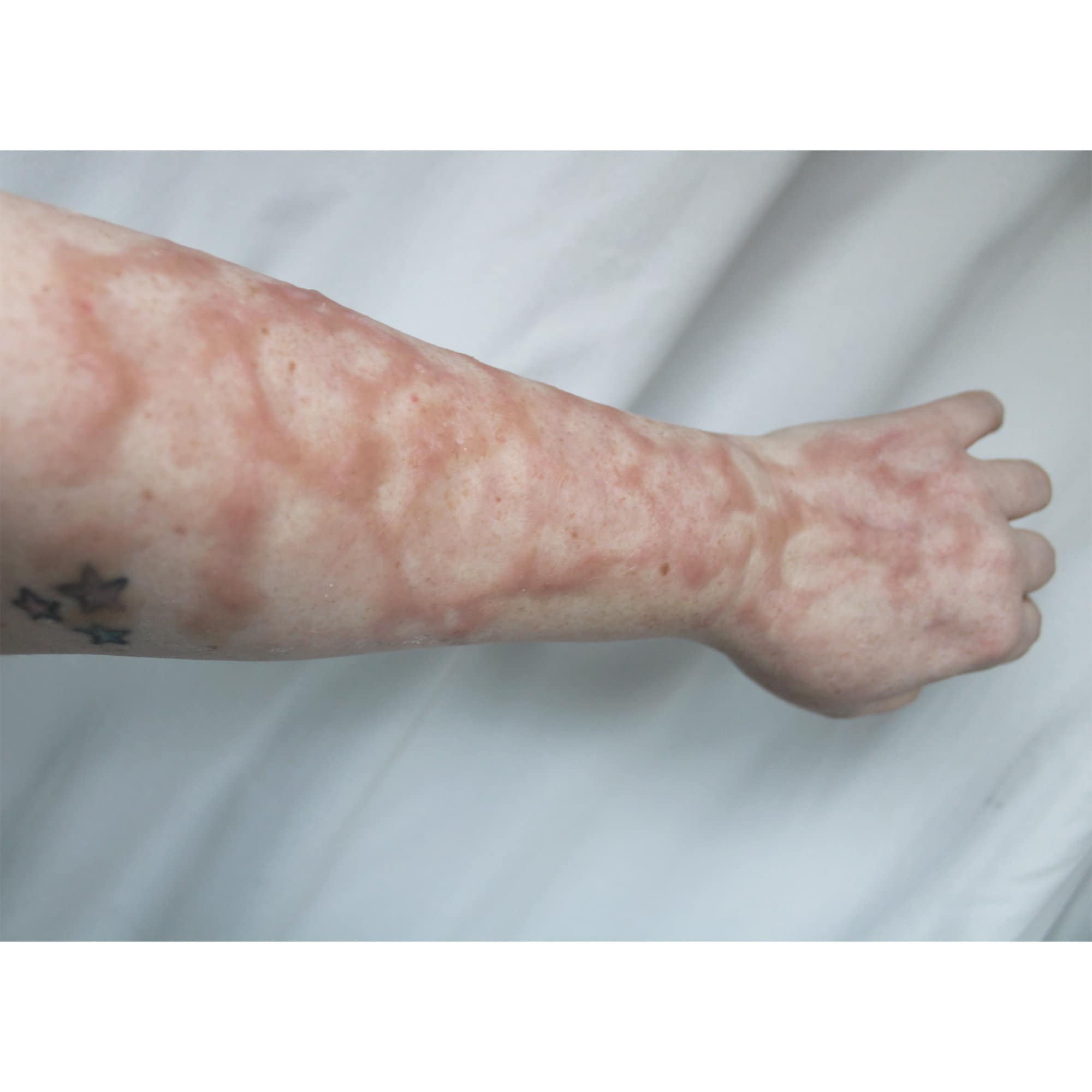 Makeup Scars Wounds Makeupview.co