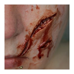 May include: Close-up of a bloody, open wound on a person's face. The wound is deep and jagged, with blood dripping from it.