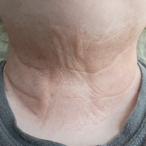 Alter Halsprothetik // Gekapselte Silikongeräte // Alterung alternde Falten im Alter // SFX MAKEUP FX // Film Tv Cosplay Halloween
