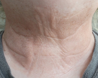 Old Age Neck Prosthetic // Encapsulated Silicone Appliance // Aging Ageing Elderly Wrinkles // SFX MAKEUP FX // Film Tv Cosplay Halloween