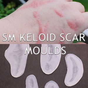 May include: Five clear silicone molds for creating realistic keloid scars. The molds are shaped like different types of keloid scars.  SM KELOID SCAR MOULDS is written in white text on a black background.