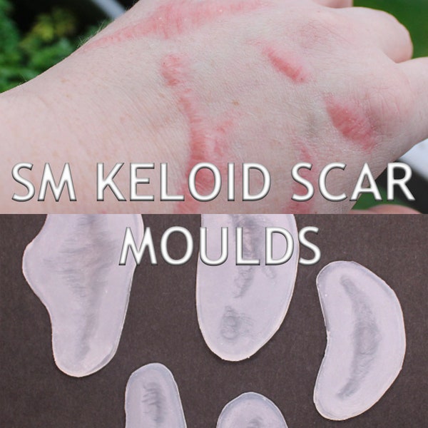 Moldes de cicatrices queloides curadas // Cinco moldes de silicona para heridas para Bondo // Prótesis // SFX MAKEUP // Cicatrización // Lesiones // Cine y TV