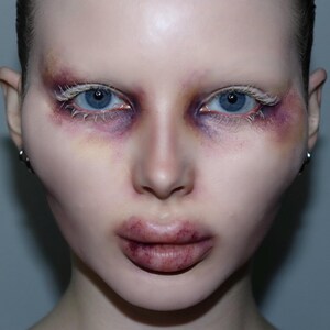 Plastic Surgery Cheekbone Prosthetics // Encapsulated Silicone ...