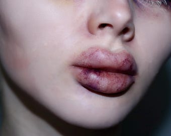 Plastic Surgery Botched Lips Prosthetic // Encapsulated Silicone // Botox Lip Filler Pout Enhanced Lips // SFX MAKEUP // Cosplay Halloween