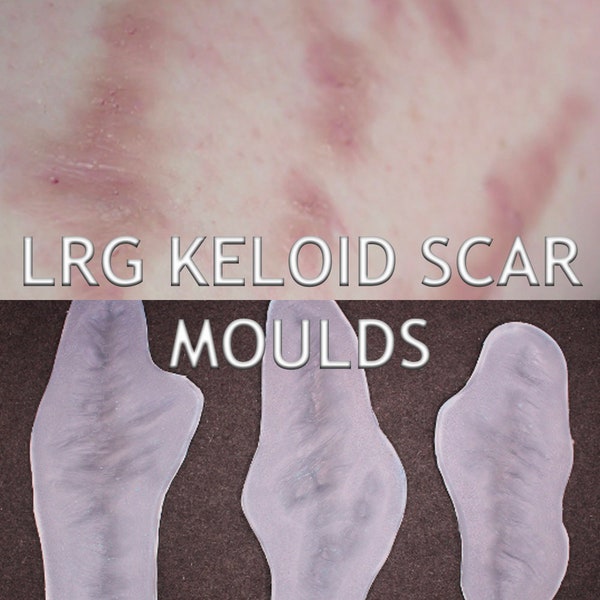 Large Keloid Scar Silicone Bondo Moulds // Prosthetics // Scarring Healed Scars Injury // TV Film Makeup // SFX MAKEUP