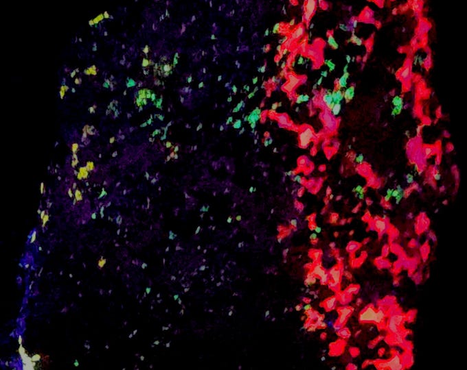 SW Shortwave Ultraviolet Fluorescent Esperite Calcite Willemite Hardystonite Franklin Mine New Jersey UV Minerals Rocks