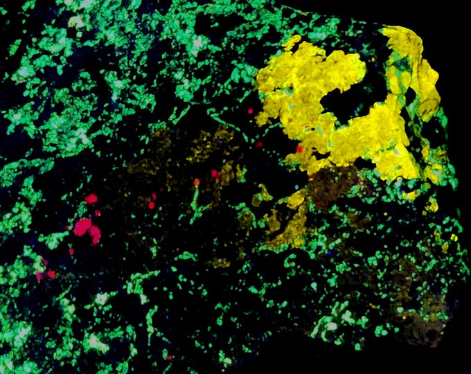 Rare A++ Shortwave SW Fluorescent Esperite Willemite & Calcite - Franklin Mine New Jersey UV Minerals Rocks