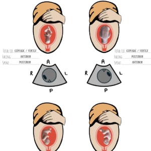 Ultrasound Study Guide: Fetal Lie / Fetal Situs
