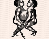 Vintage Edwardian Anatomical Clipart | Antique Fetal Omphalopagus Conjoined Twins | Siamese Twins SVG PNG JPG