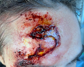 Realistic Deep Forehead Wound Prosthetic – Encapsulated Silicone/Cap Plastic Appliance–SFX Makeup for Film, Cosplay, Halloween, Short Films