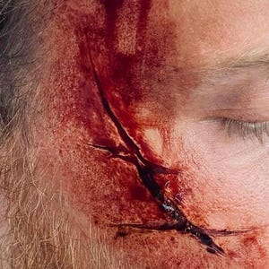 Può includere: Un'applicazione di trucco protesico realistico che raffigura una lacerazione profonda e frastagliata su una guancia. La ferita presenta bordi cutanei strutturati e rialzati con colorazioni rosso intenso e cremisi.