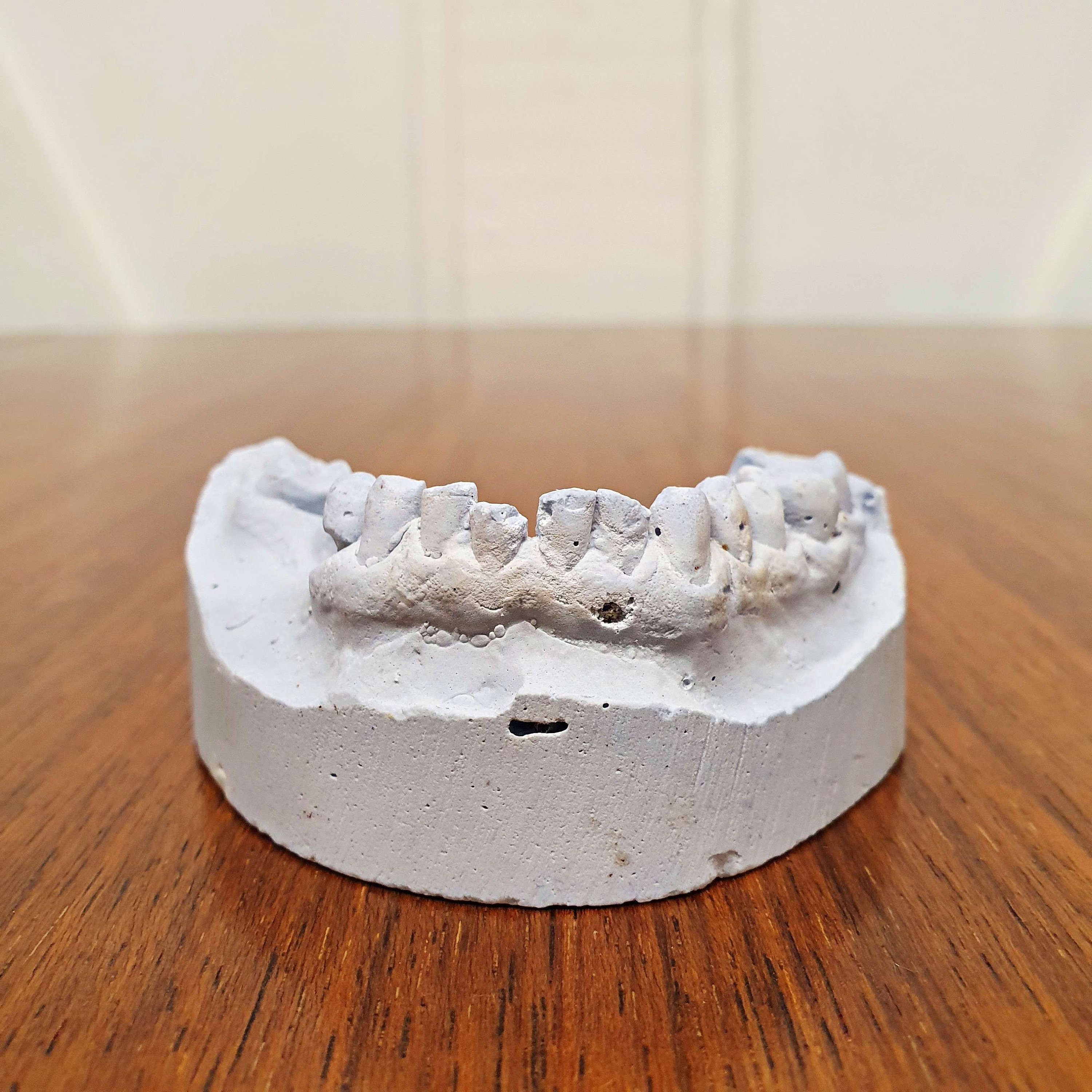  Molde de material de impresión de moldes de base anterior  modelo de yeso de silicona dental 6pcs : Industrial y Científico