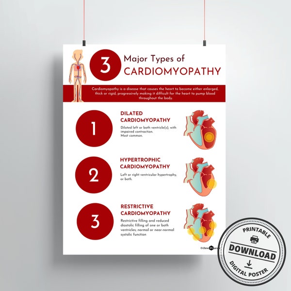 Types of Cardiomyopathy Print | DIGITAL DOWNLOAD | Cardiologist Gift | Doctor Office Decor | Cardiovascular system | Medical Office Art