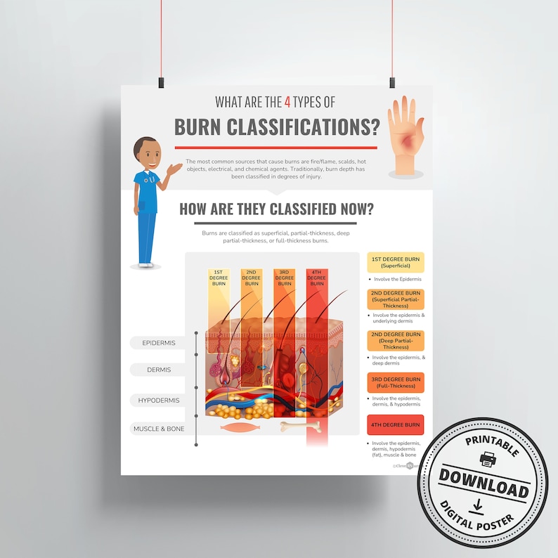 Burn Classifications Print | DIGITAL DOWNLOAD | Dermatologist Gift ...