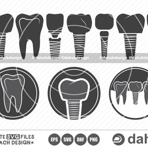 Implante dental SVG, Icono de implante, Fuentes de iconos, Dentista, Icono de implante dental, Vector de implante dental, Archivo de corte, para silueta, SVG, EPS, DXF