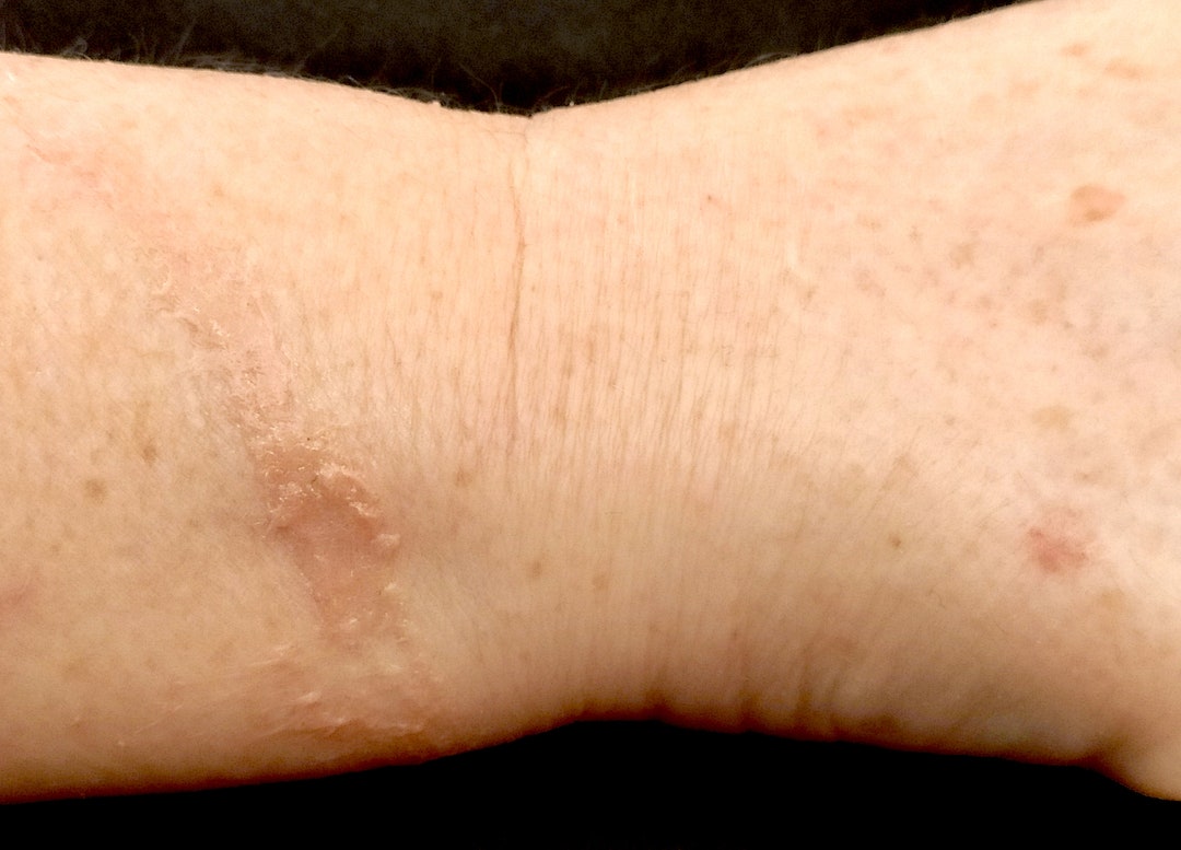 Scar Prothesis FX Prosthetic Long Scar - Etsy UK