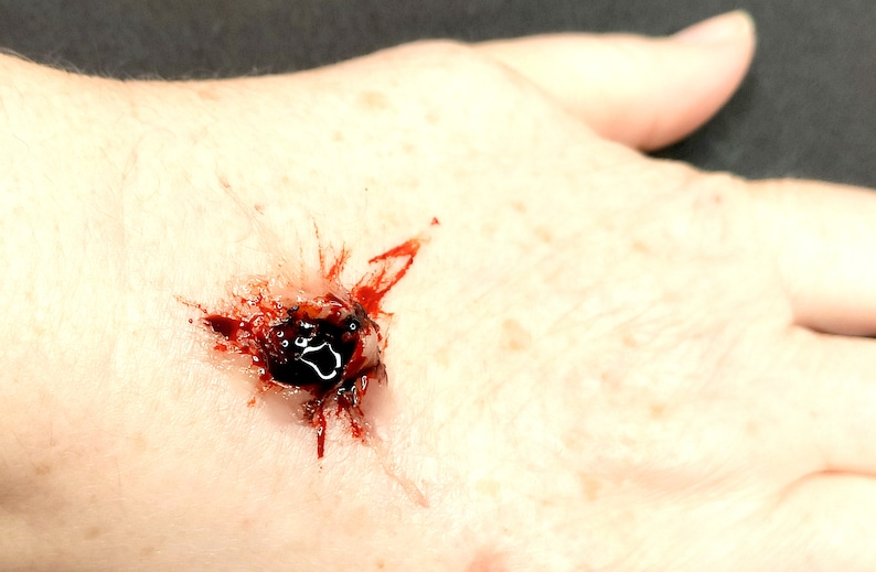 FX prosthetic bullet wound