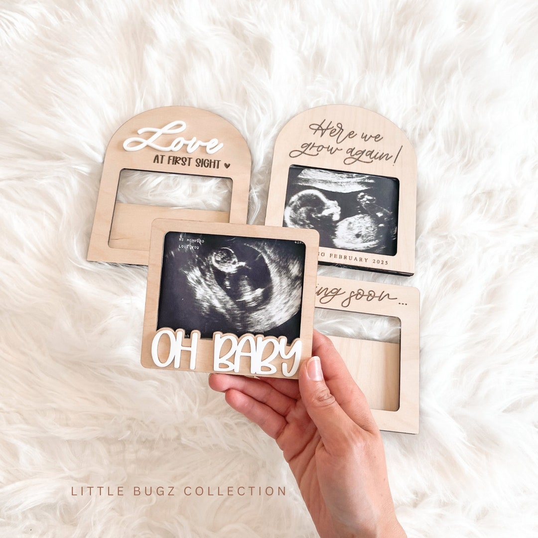 Sonogram Magnets Ultrasound Fridge Magnet, Pregnancy Announcement Frame, Pregnancy ...