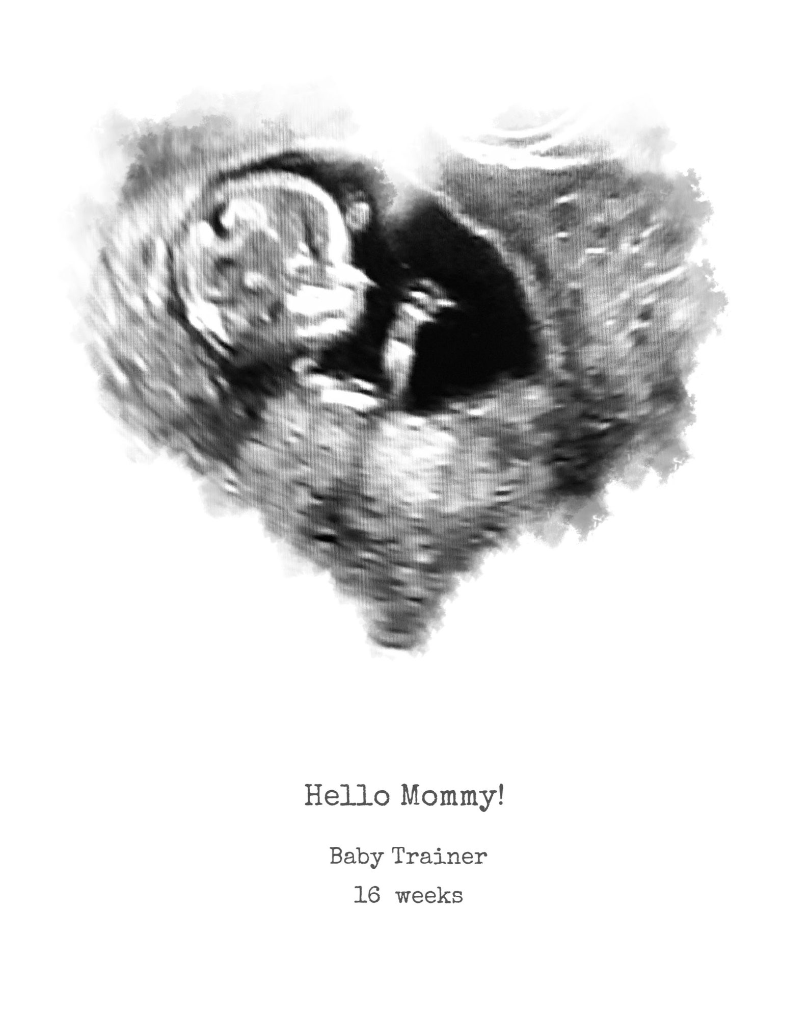 Ultrasound Art Heart Ultrasound Print Digital Download Etsy