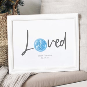 loved, embryo art, ivf, ivf gift, digital download, ttc, infertility, embryo transfer, embryo adoption, pregnancy announcement, ivf miracle