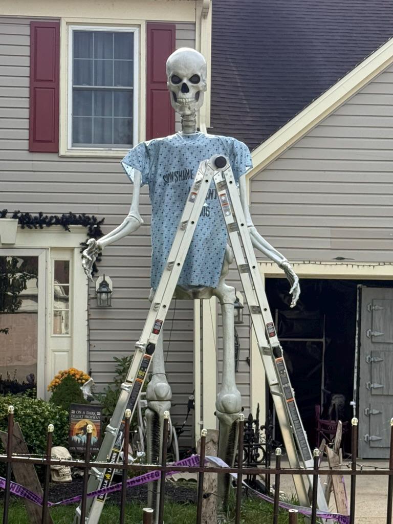 12' Giant Skeleton Full Joint Replacement Kit – Carbon Fiber PETG ...