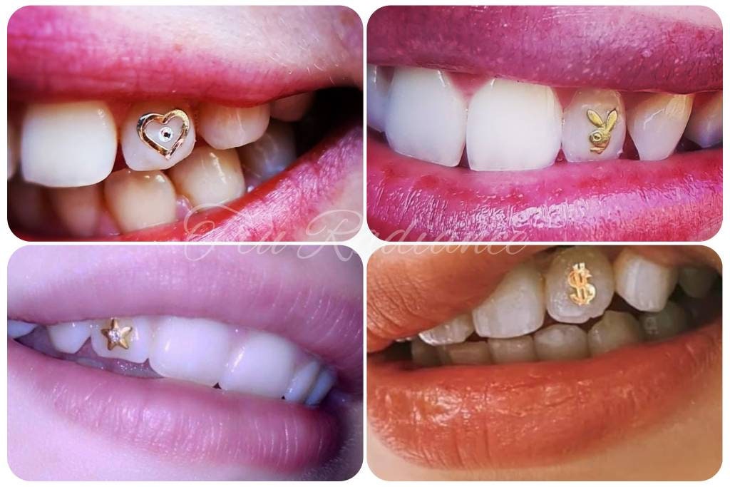 4Pcs/Box Dental Tooth Gems Crystal Diamond Ornament Various Shapes Color  Teeth Jewelry Denture Acrylic