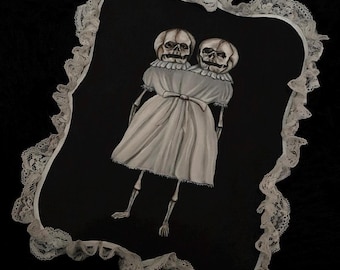 Arte de rarezas: esqueleto de gemelos siameses fetales.