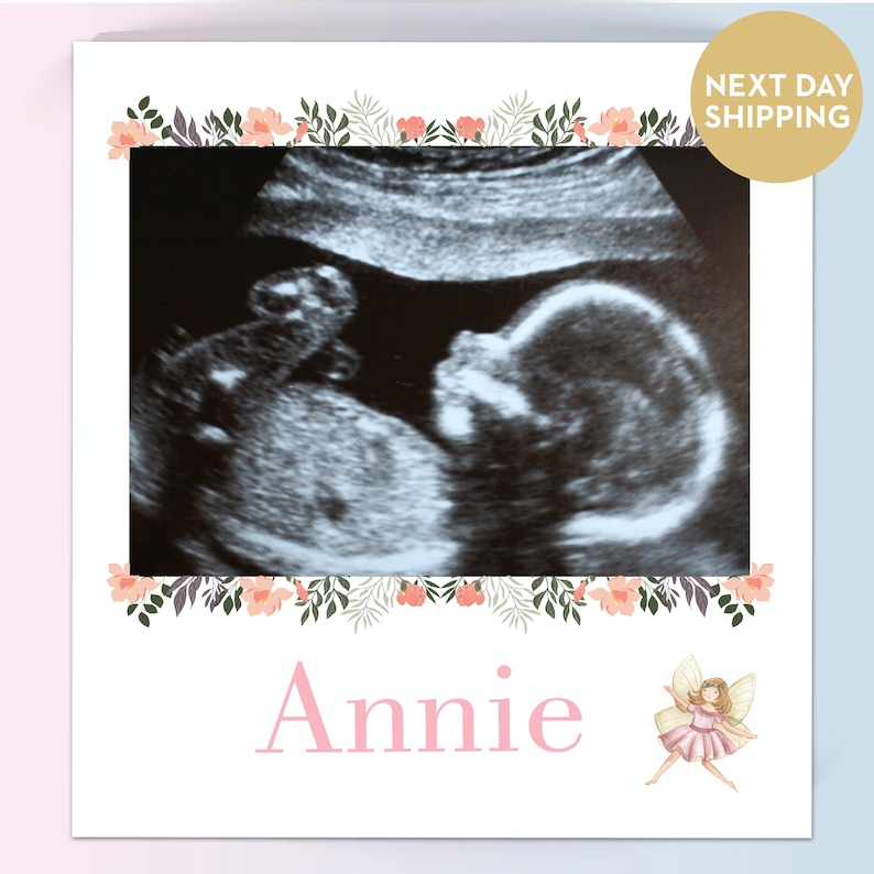 Sonogram Magnets Pregnancy Announcement, Ultrasound Gift, Sonogram Magnet, Gender Reveal ...