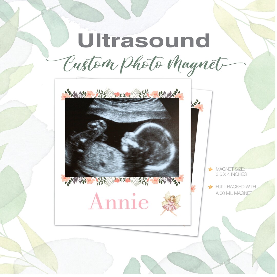 Sonogram Magnets Pregnancy Announcement, Ultrasound Gift, Sonogram Magnet, Gender Reveal ...