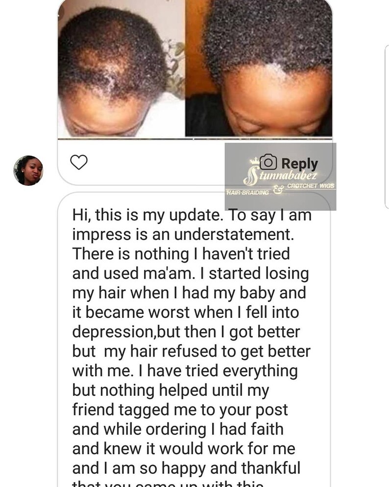 Rice Milk Conditioning Spray by Stunnababez32oz Etsy