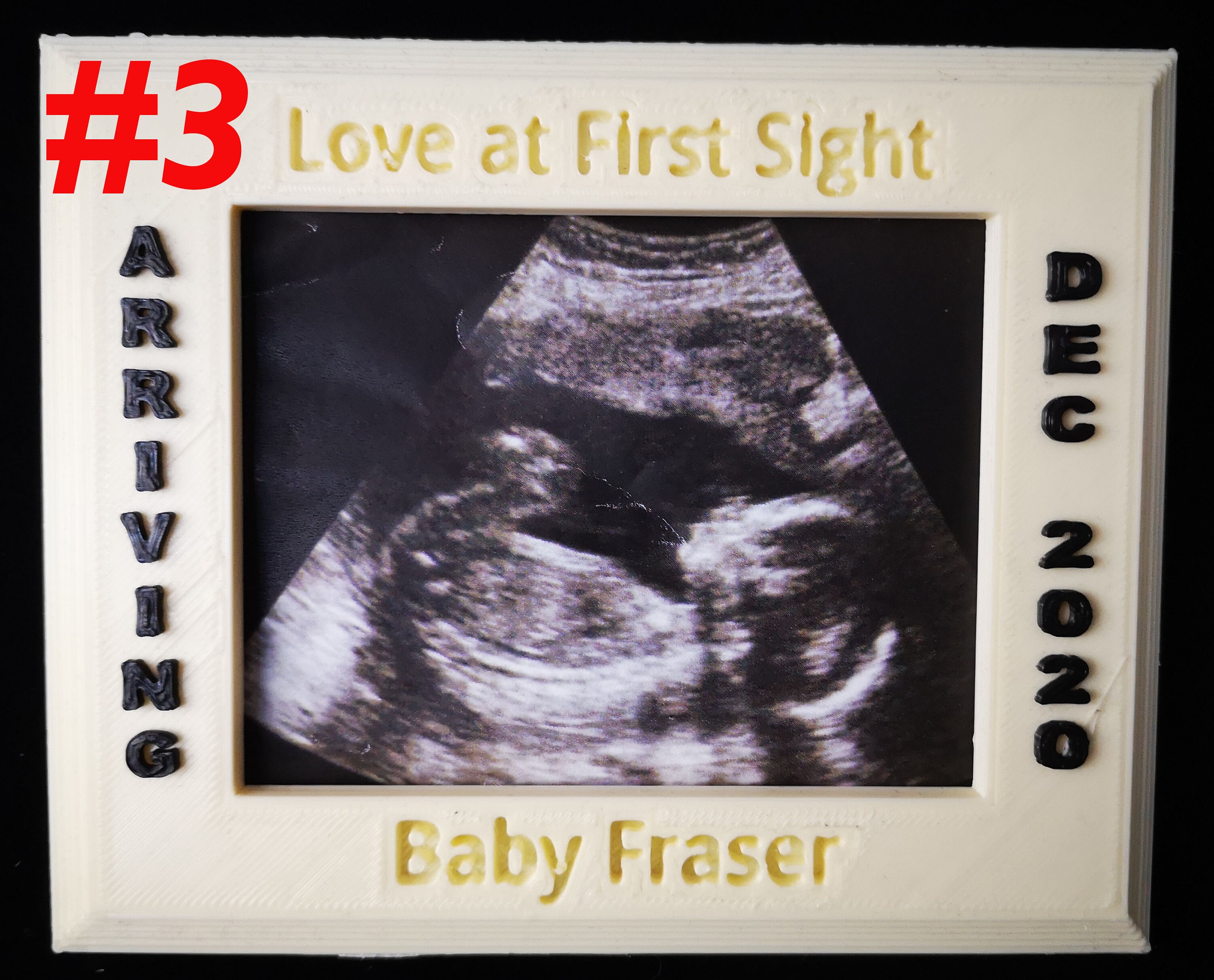 Personalized Baby Ultrasound Scan Frames Etsy