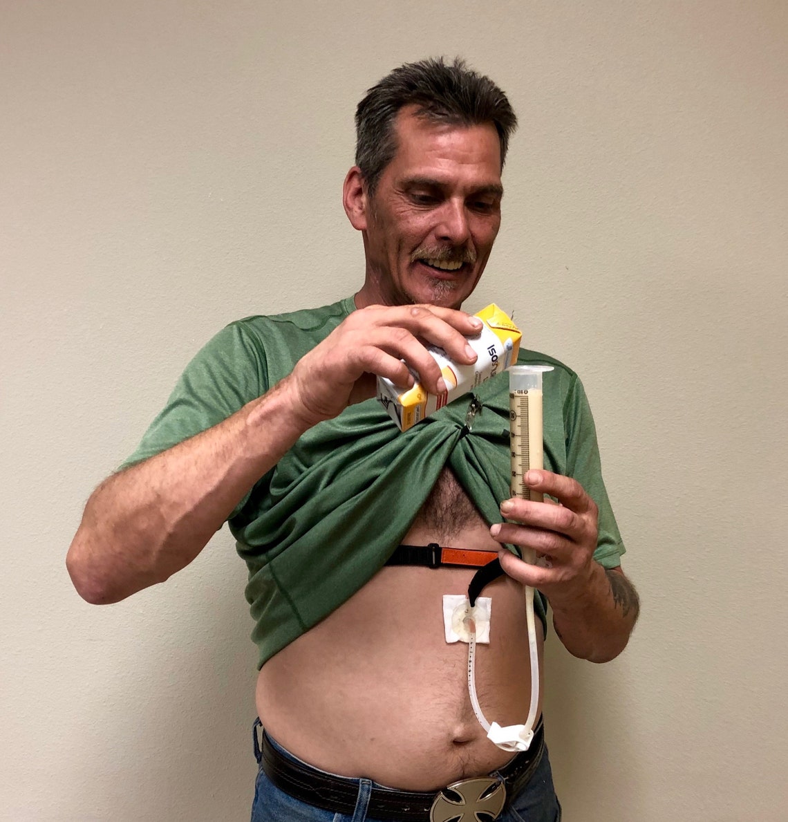 Comfort Feed Feeding Tube Belt and Comfort Wraps. PEG tube/J Etsy