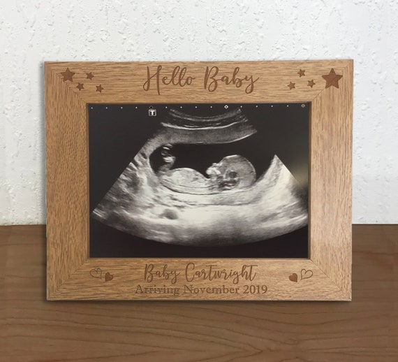 personalised baby scan