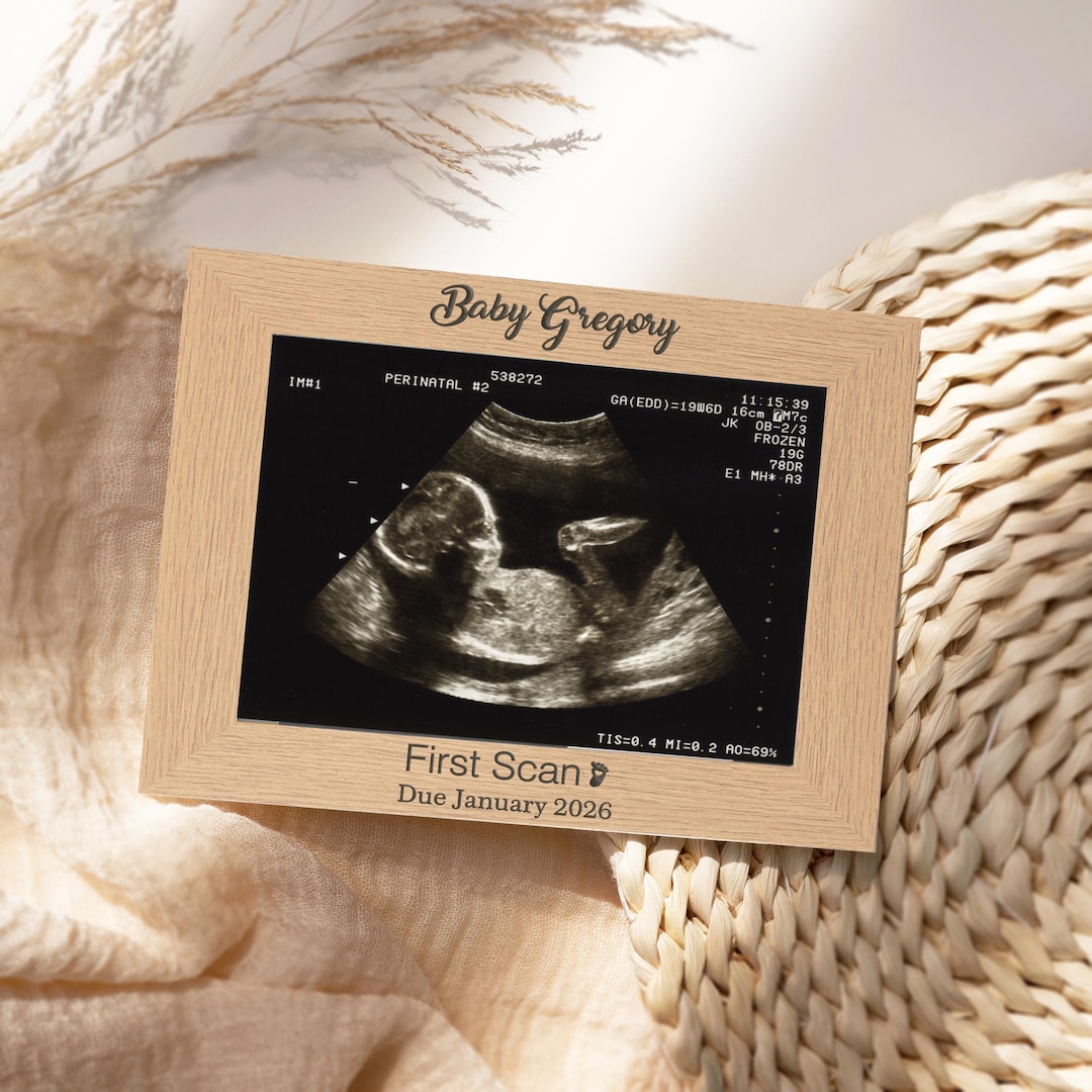 Baby Scan Photo Frame, First Scan Picture Frame, Gender Scan Keepsake ...