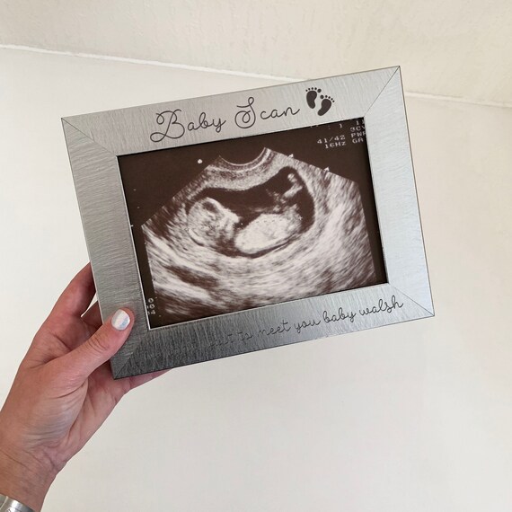 Cadre photo Baby Scan, Photo personnalisée Baby Scan, Cadeau