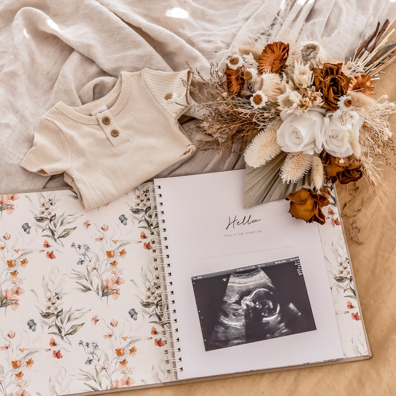 K&ouml;nnte beinhalten: Ein wei&szlig;er Baby-Strampler mit Knopfleiste, ein Scrapbook mit Blumenmuster, ein Trockenblumenstrau&szlig; und ein Schwarzwei&szlig;-Ultraschallbild. Das Scrapbook hat den Text "Hello, This is the story of..." auf dem Cover.