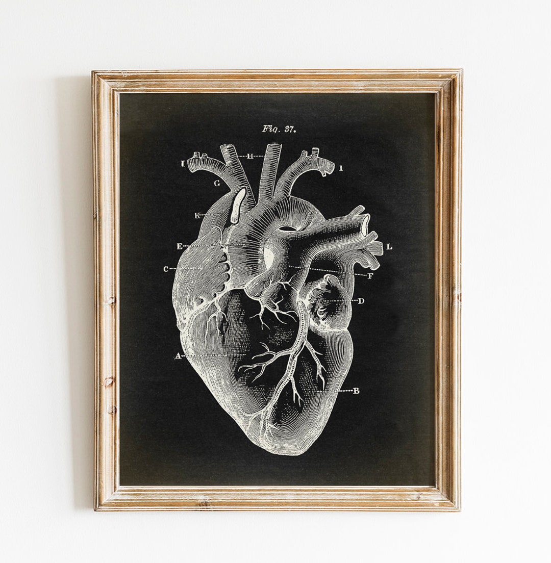 Heart Medical Print, PRINTABLE Vintage Illustration, Human Heart ...