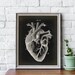 Heart Medical Print, PRINTABLE Vintage Illustration, Human Heart ...