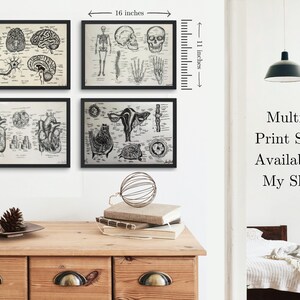 May include: Four black framed prints of vintage anatomical illustrations. The prints depict the human brain, skeleton, heart, and female reproductive system. The prints are arranged in a grid on a white wall. The prints are 11 inches tall and 16 inches wide.