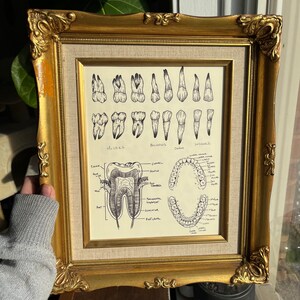 Dental anatomy art print, dental wall art, dental hygienist gift, dentist gift, teeth art, cosmetic dentist art, anatomy diagram, tooth art