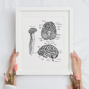 May include: A black and white anatomical illustration of the human brain and spinal cord. The illustration includes labels for the different parts of the brain and spinal cord. The text "CRANIAL NERVES" is written in the center of the image. The text "LATERAL VIEW" is written in the bottom right corner of the image.