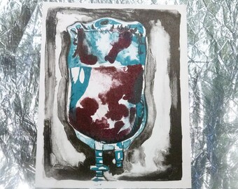 IV Bag Lithograph Print