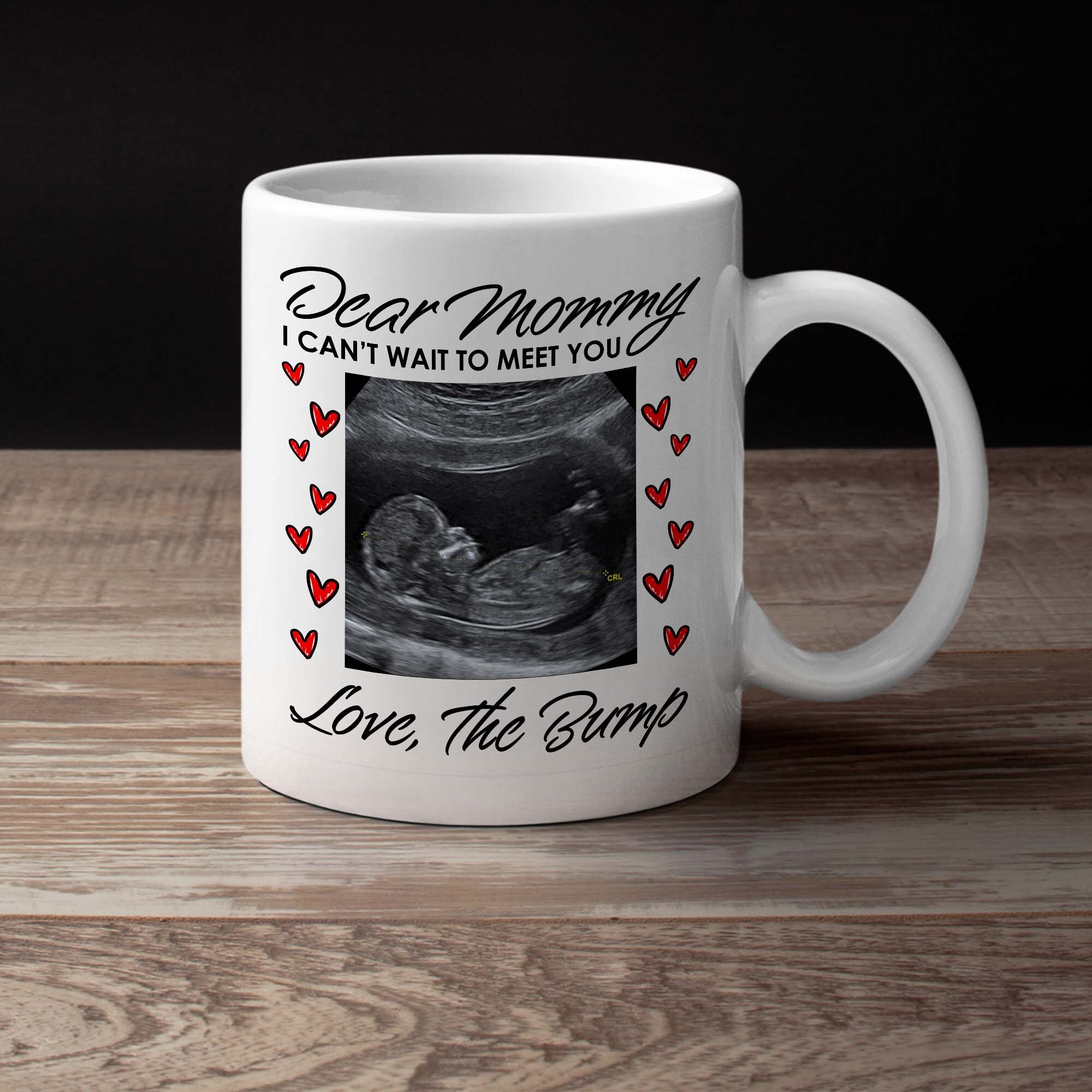 Custom Ultrasound Photo Expecting Mom Gift For Mothers Day Etsy