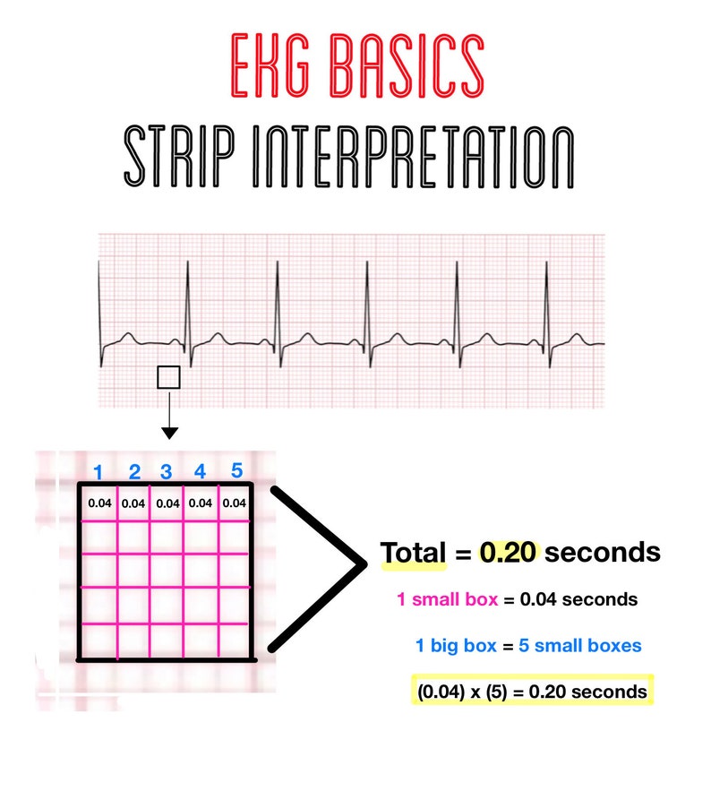 Ekg Study Guide Ekg Interpretation Ecg Rhythms Nursing - Etsy